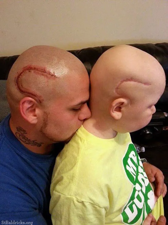 父と息子　脳手術　タトゥー