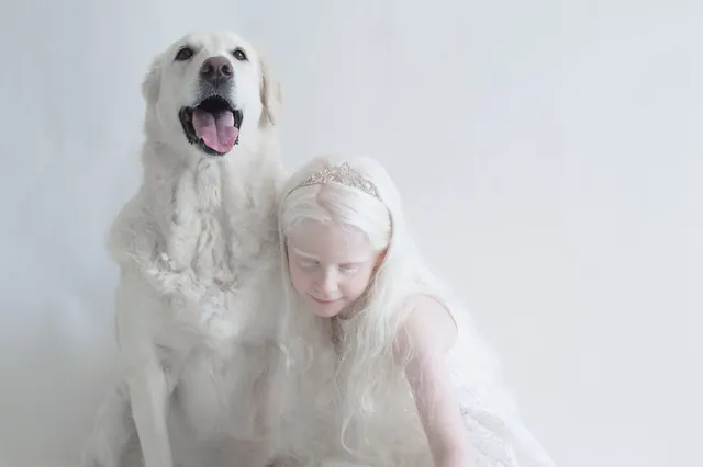 アルビノの女の子と犬